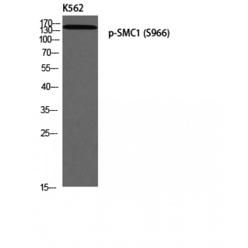 SMC1A / SMC1 Antibody - Western blot of Phospho-SMC1 (S966) antibody
