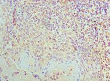 SMC1A / SMC1 Antibody - Immunohistochemistry of paraffin-embedded human tonsil using antibody at 1:100 dilution.