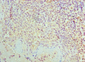 SMC1A / SMC1 Antibody - Immunohistochemistry of paraffin-embedded human tonsil tissue using SMC1A Antibody at dilution of 1:100