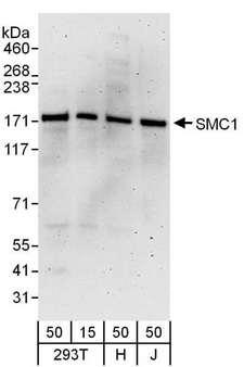 SMC1A / SMC1 Antibody - Detection of Human SMC1 by Western Blot. Samples: Whole cell lysate from 293T (15 and 50 ug), HeLa (H; 50 ug), and Jurkat (J; 50 ug) cells. Antibodies: Affinity purified goat anti-SMC1 antibody used for WB at 0.1 ug/ml. Detection: Chemiluminescence with an exposure time of 3 minutes.