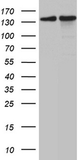 SMC1A / SMC1 Antibody - HEK293T cells were transfected with the pCMV6-ENTRY control. (Left lane) or pCMV6-ENTRY SMC1A. (Right lane) cDNA for 48 hrs and lysed. Equivalent amounts of cell lysates. (5 ug per lane) were separated by SDS-PAGE and immunoblotted with anti-SMC1A. (1:2000)
