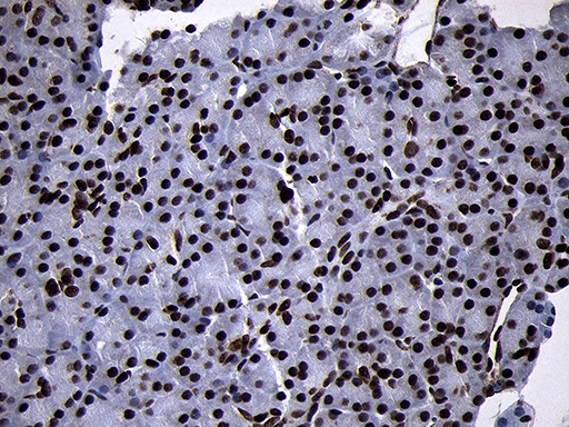 SMC1A / SMC1 Antibody - Immunohistochemical staining of paraffin-embedded Human pancreas tissue within the normal limits using anti-SMC1A mouse monoclonal antibody. (Heat-induced epitope retrieval by 1mM EDTA in 10mM Tris buffer. (pH8.5) at 120°C for 3 min. (1:1000)