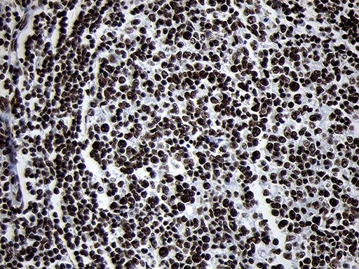 SMC1A / SMC1 Antibody - Immunohistochemical staining of paraffin-embedded Human lymph node tissue within the normal limits using anti-SMC1A mouse monoclonal antibody. (Heat-induced epitope retrieval by 1mM EDTA in 10mM Tris buffer. (pH8.5) at 120°C for 3 min. (1:1000)