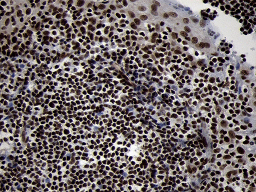 SMC1A / SMC1 Antibody - Immunohistochemical staining of paraffin-embedded Human tonsil within the normal limits using anti-SMC1A mouse monoclonal antibody. (Heat-induced epitope retrieval by 1mM EDTA in 10mM Tris buffer. (pH8.5) at 120°C for 3 min. (1:1000)