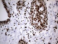SMC1A / SMC1 Antibody - Immunohistochemical staining of paraffin-embedded Human breast tissue within the normal limits using anti-SMC1A mouse monoclonal antibody. (Heat-induced epitope retrieval by 1mM EDTA in 10mM Tris buffer. (pH8.5) at 120°C for 3 min. (1:500)