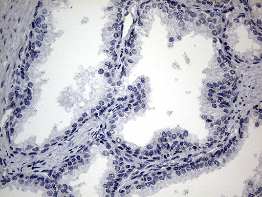 SMC1A / SMC1 Antibody - Immunohistochemical staining of paraffin-embedded Human prostate tissue within the normal limits using anti-SMC1A mouse monoclonal antibody. This figure shows negative staining. (Heat-induced epitope retrieval by 1mM EDTA in 10mM Tris buffer. (pH8.5) at 120°C for 3 min. (1:500)