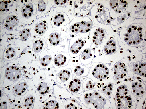 SMC1A / SMC1 Antibody - Immunohistochemical staining of paraffin-embedded Human gastric tissue within the normal limits using anti-SMC1A mouse monoclonal antibody. (Heat-induced epitope retrieval by Tris-EDTA(1:500)