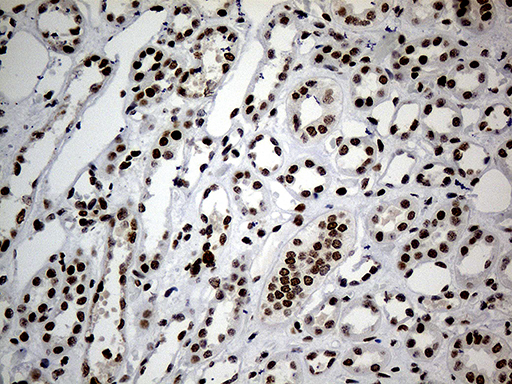SMC1A / SMC1 Antibody - Immunohistochemical staining of paraffin-embedded Human Kidney tissue within the normal limits using anti-SMC1A mouse monoclonal antibody. (Heat-induced epitope retrieval by 1mM EDTA in 10mM Tris buffer. (pH8.5) at 120°C for 3 min. (1:500)