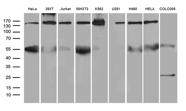 SMC1A / SMC1 Antibody - Western blot analysis of extracts. (35ug) from 9 different cell lines by using anti-SMC1A monoclonal antibody. (1:500)