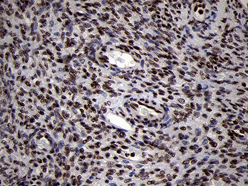 SMC1A / SMC1 Antibody - Immunohistochemical staining of paraffin-embedded Human Ovary tissue within the normal limits using anti-SMC1A mouse monoclonal antibody. (Heat-induced epitope retrieval by 1mM EDTA in 10mM Tris buffer. (pH8.5) at 120°C for 3 min. (1:500)