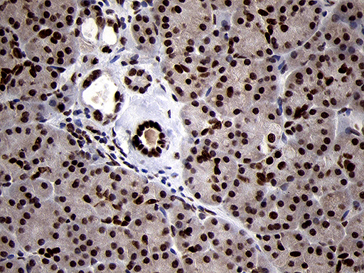 SMC1A / SMC1 Antibody - Immunohistochemical staining of paraffin-embedded Human pancreas tissue within the normal limits using anti-SMC1A mouse monoclonal antibody. (Heat-induced epitope retrieval by 1mM EDTA in 10mM Tris buffer. (pH8.5) at 120°C for 3 min. (1:500)