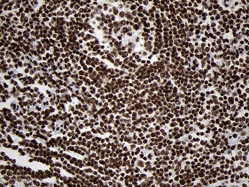 SMC1A / SMC1 Antibody - Immunohistochemical staining of paraffin-embedded Human lymph node tissue within the normal limits using anti-SMC1A mouse monoclonal antibody. (Heat-induced epitope retrieval by 1mM EDTA in 10mM Tris buffer. (pH8.5) at 120°C for 3 min. (1:500)