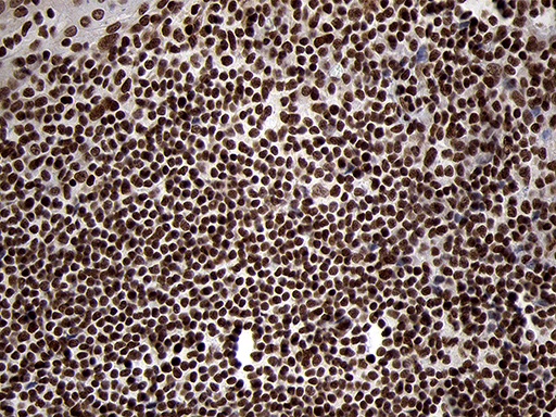SMC1A / SMC1 Antibody - Immunohistochemical staining of paraffin-embedded Human tonsil within the normal limits using anti-SMC1A mouse monoclonal antibody. (Heat-induced epitope retrieval by 1mM EDTA in 10mM Tris buffer. (pH8.5) at 120°C for 3 min. (1:500)