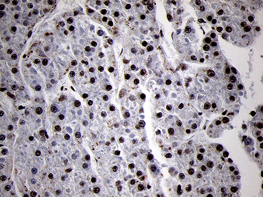 SMC1A / SMC1 Antibody - Immunohistochemical staining of paraffin-embedded Human liver tissue within the normal limits using anti-SMC1A mouse monoclonal antibody. (Heat-induced epitope retrieval by 1mM EDTA in 10mM Tris buffer. (pH8.5) at 120°C for 3 min. (1:500)