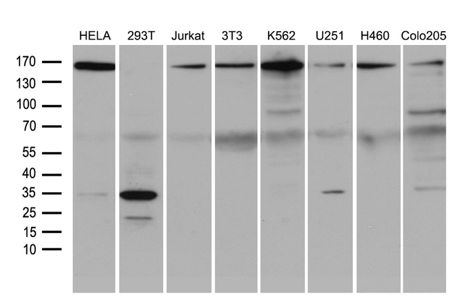 SMC1A / SMC1 Antibody - Western blot analysis of extracts. (35ug) from 8 different cell lines by using anti-SMC1A monoclonal antibody. (1:500)