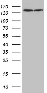SMC1A / SMC1 Antibody - HEK293T cells were transfected with the pCMV6-ENTRY control. (Left lane) or pCMV6-ENTRY SMC1A. (Right lane) cDNA for 48 hrs and lysed