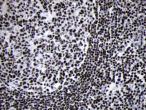 SMC1A / SMC1 Antibody - Immunohistochemical staining of paraffin-embedded Human lymph node tissue within the normal limits using anti-SMC1A mouse monoclonal antibody. (Heat-induced epitope retrieval by 1mM EDTA in 10mM Tris buffer. (pH8.5) at 120°C for 3 min. (1:500)