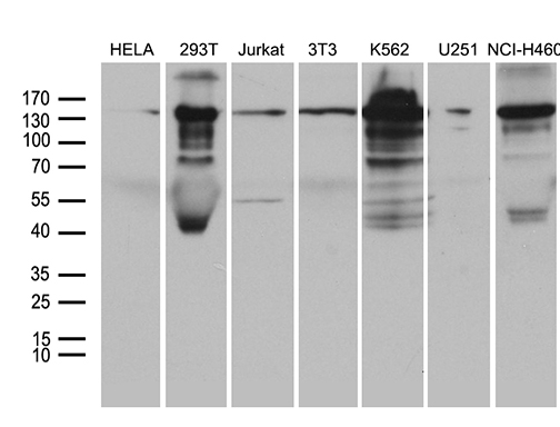 SMC1A / SMC1 Antibody - Western blot analysis of extracts. (35ug) from 7 different cell lines by using anti-SMC1A monoclonal antibody. (1:500)