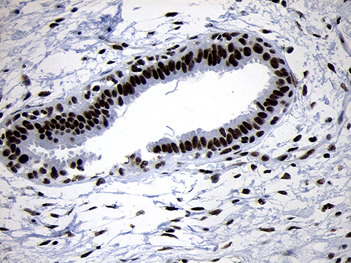 SMC1A / SMC1 Antibody - Immunohistochemical staining of paraffin-embedded Human breast tissue within the normal limits using anti-SMC1A mouse monoclonal antibody. (Heat-induced epitope retrieval by 1mM EDTA in 10mM Tris buffer. (pH8.5) at 120°C for 3 min. (1:500)