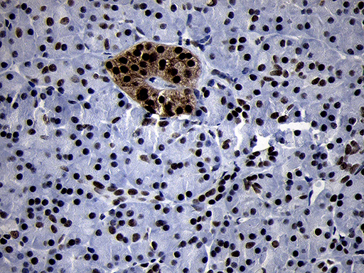 SMC1A / SMC1 Antibody - Immunohistochemical staining of paraffin-embedded Human pancreas tissue within the normal limits using anti-SMC1A mouse monoclonal antibody. (Heat-induced epitope retrieval by 1mM EDTA in 10mM Tris buffer. (pH8.5) at 120°C for 3 min. (1:500)