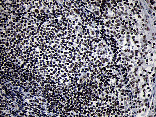 SMC1A / SMC1 Antibody - Immunohistochemical staining of paraffin-embedded Human tonsil within the normal limits using anti-SMC1A mouse monoclonal antibody. (Heat-induced epitope retrieval by 1mM EDTA in 10mM Tris buffer. (pH8.5) at 120°C for 3 min. (1:500)