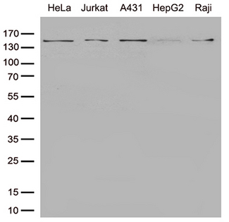 SMC1A / SMC1 Antibody - Western blot analysis of extracts. (35ug) from cell lines by using anti-SMC1A monoclonal antibody. (1:500)