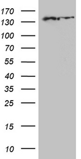 SMC1A / SMC1 Antibody - HEK293T cells were transfected with the pCMV6-ENTRY control. (Left lane) or pCMV6-ENTRY SMC1A. (Right lane) cDNA for 48 hrs and lysed