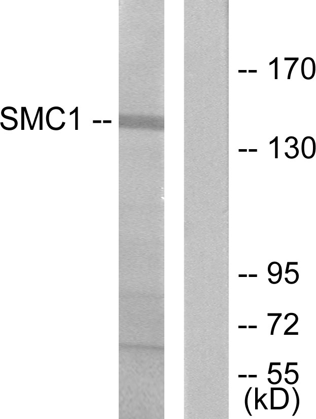 SMC1A / SMC1 Antibody - Western blot analysis of lysates from 293 cells, treated with UV 15', using SMC1 Antibody. The lane on the right is blocked with the synthesized peptide.