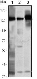 SMC1A / SMC1 Antibody - Western blot using SMC1 mouse monoclonal antibody against K562 (1), Jurkat (2) and A549 (3) cell lysate.
