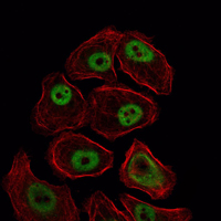 SMC1A / SMC1 Antibody - Immunofluorescence of NIH/3T3 cells using SMC1 mouse monoclonal antibody (green). Red: Actin filaments have been labeled with Alexa Fluor-555 phalloidin.