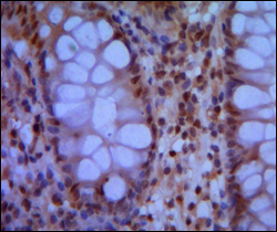SMC1A / SMC1 Antibody - IHC of paraffin-embedded human colon using SMC1 mouse monoclonal antibody with DAB staining.