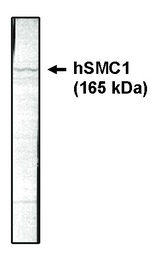 SMC1A / SMC1 Antibody - Western blotting using SMC1 antibody on HeLa cell lysate at 1 ug/ml.