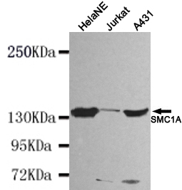 SMC1A / SMC1 Antibody - Western blot detection of SMC1A(N-terminus) in HeLa NE, Jurkat and A431 cell lysates using SMC1A (N-terminus) mouse monoclonal antibody (1:1000 dilution). Predicted band size: 143KDa. Observed band size: 143KDa.