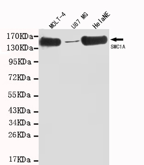 SMC1A / SMC1 Antibody - Western blot detection of SMC1A(C-term) in MOLT-4, U87 MG and HeLa NE cell lysates using SMC1A (N-terminus) mouse monoclonal antibody (1:1000 dilution). Predicted band size: 143KDa. Observed band size: 143KDa.