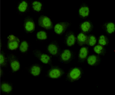 SMC1A / SMC1 Antibody - Immunocytochemistry staining of HeLa cells fixed with 4% Paraformaldehyde and using anti-SMC1A mouse monoclonal antibody(dilution 1:100).