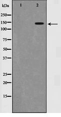 SMC1A / SMC1 Antibody - Western blot of SMC1 expression in UV treated 293 whole cell lysates,The lane on the left is treated with the antigen-specific peptide.