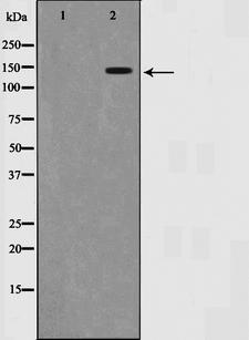SMC1A / SMC1 Antibody - Western blot analysis of SMC1 expression in UV treated 293 whole cells lysates. The lane on the left is treated with the antigen-specific peptide.