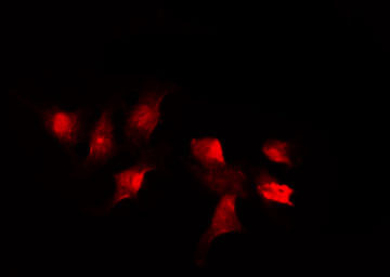 SMC1A / SMC1 Antibody - Staining HuvEc cells by IF/ICC. The samples were fixed with PFA and permeabilized in 0.1% Triton X-100, then blocked in 10% serum for 45 min at 25°C. The primary antibody was diluted at 1:200 and incubated with the sample for 1 hour at 37°C. An Alexa Fluor 594 conjugated goat anti-rabbit IgG (H+L) Ab, diluted at 1/600, was used as the secondary antibody.