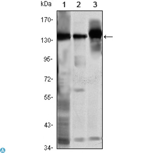 SMC1A / SMC1 Antibody - Western Blot (WB) analysis using SMC1 Monoclonal Antibody against K562 (1), Jurkat (2) and A549 (3) cell lysate.