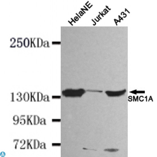 SMC1A / SMC1 Antibody - Western blot detection of SMC1A (N-term) in HelaNE, Jurkat and A431 cell lysates using SMC1A (N-term) mouse mAb (1:1000 diluted). Predicted band size: 143KDa. Observed band size: 143KDa.