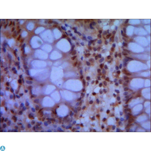 SMC1A / SMC1 Antibody - IHC of paraffin-embedded human colon using anti-SMC1A (N-term) mouse mAb diluted 1:500-1:1000.