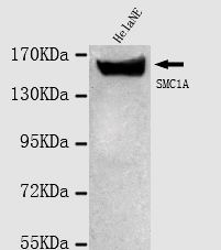 SMC1A / SMC1 Antibody - Western blot detection of SMC1A in HeLa cell lysates using SMC1A antibody (1:1000 diluted).