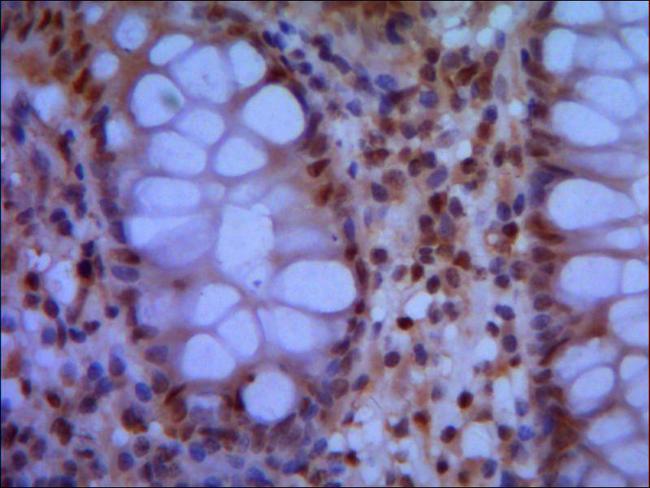 SMC1A / SMC1 Antibody - IHC of paraffin-embedded human colon using anti-SMC1A (N-terminus) diluted 1/500-1/1000.