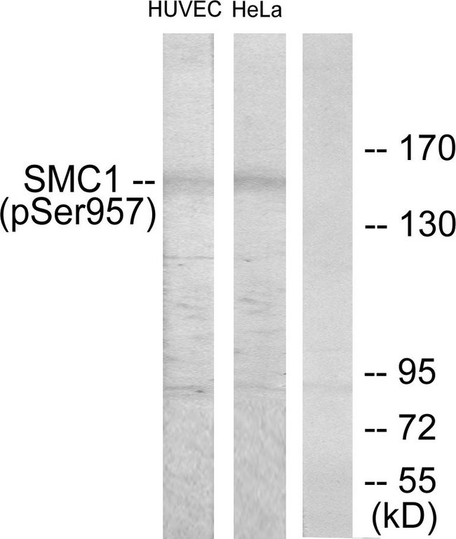 SMC1A / SMC1 Antibody - Western blot analysis of lysates from HUVEC cells treated with EGF 200ng/ml 5'/HeLa cells treated with EGF 200ng/ml 15', using SMC1 (Phospho-Ser957) Antibody. The lane on the right is blocked with the phospho peptide.
