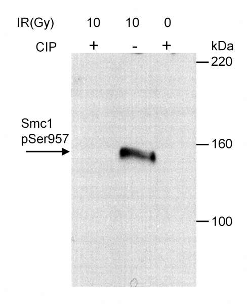 SMC1A / SMC1 Antibody - Detection of Human Phospho SMC1 (Ser957) by Western Blot. Sample: Whole cell extracts from HeLa cells (30 ug/lane) that were irradiated with 10 Gy of ionizing radiation or mock irradiated. Irradiated lysate was then treated with calf intestinal phosphatase (CIP) or left untreated. Antibody: Affinity purified rabbit anti-SMC1 pSer957 used at 0.1 ug/ml. Detection: Chemiluminescence with 30 second exposure.