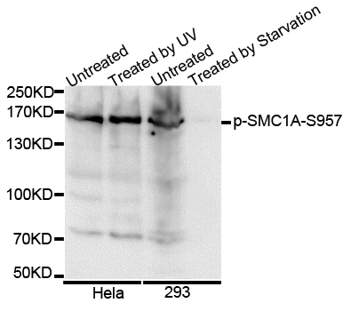SMC1A / SMC1 Antibody - Western blot analysis of extracts of various cell lines.