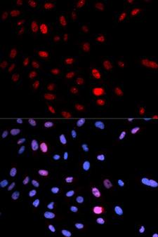 SMC1A / SMC1 Antibody - Immunofluorescence analysis of U2OS cells.