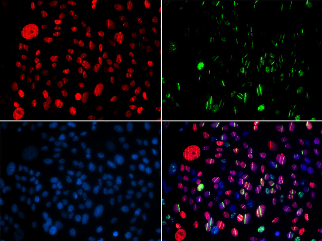 SMC1A / SMC1 Antibody - Immunofluorescence analysis of GFP-RNF168 transgenic U2OS cells.