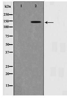 SMC1A / SMC1 Antibody - Western blot of SMC1 phosphorylation expression in HUVEC whole cell lysates,The lane on the left is treated with the antigen-specific peptide.