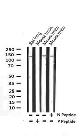 SMC1A / SMC1 Antibody - Western blot analysis of Phospho-SMC1 (Ser957) expression in various lysates